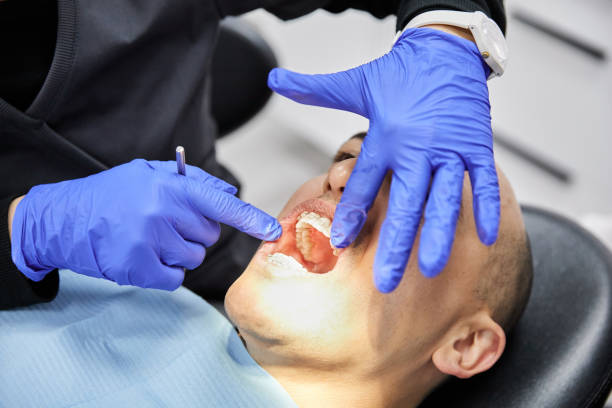 Best Emergency Wisdom Tooth Extraction in Lanham, MD